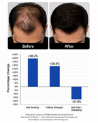 Peptide Hair Growth Serum