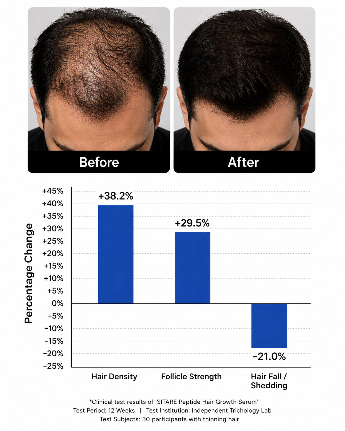Peptide Hair Growth Serum